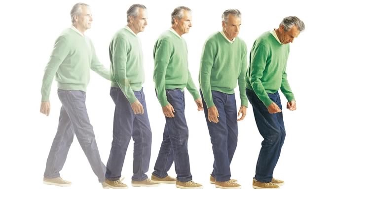 Parkinson’s stages: Signs and symptoms